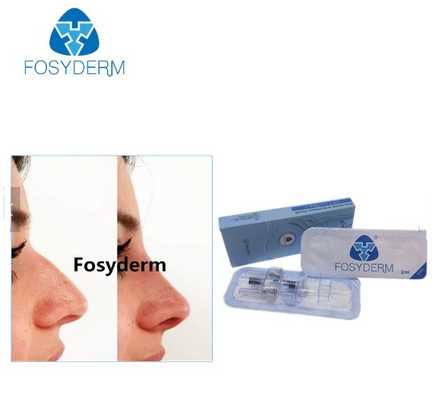 Βαθιές εγχύσεις υδροχλωρικού οξέος γραμμών Fosyderm 1ml στο πρόσωπο για τη μύτη επάνω