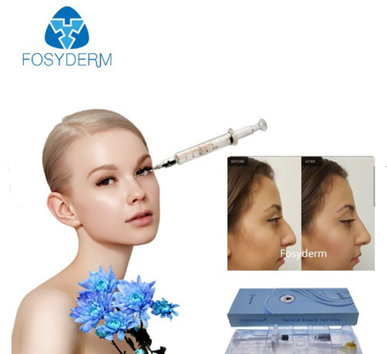 Βαθιές εγχύσεις υδροχλωρικού οξέος γραμμών Fosyderm 1ml στο πρόσωπο για τη μύτη επάνω