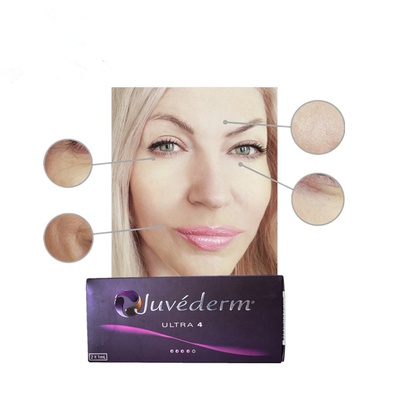 Juvederm Ultral 4 Hyaluronic όξινες δερμικές εγχύσεις υλικών πληρώσεως με τη λιδοκαΐνη