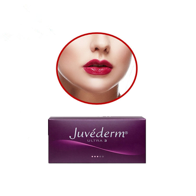 Juvederm εξαιρετικά 3 Hyaluronic όξινα δερμικά ρωσικά χείλια υλικών πληρώσεως με τη λιδοκαΐνη
