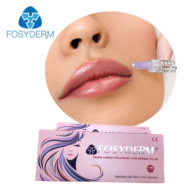 Το χείλι γεμίζει το μάγουλο που ανυψώνει το του προσώπου δερμικό υλικό πληρώσεως εκχύσιμο Fosyderm 2ml εκταρίου