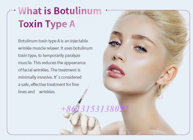 Botulinum τοξίνη