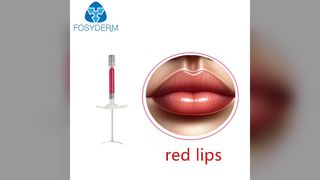 κόκκινα χείλη
