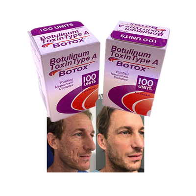Injection Powder Allergan Cosmetics Anti Aging Wrinkle 100 Units
