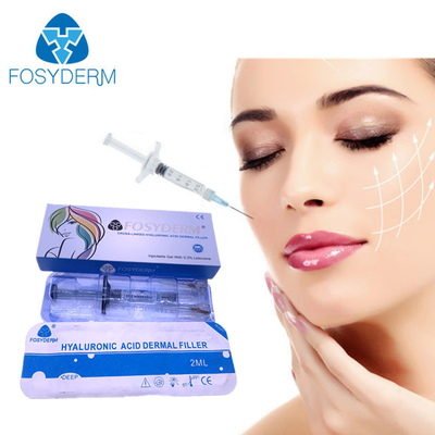 υλικό πληρώσεως 2ml Fosyderm για τα χείλια μάγουλων πηγουνιών που αφαιρούν το Hyaluronic οξύ ρυτίδων