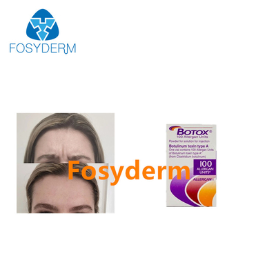 Οι Botulinum εγχύσεις τοξινών Allergan αφαιρούν τις ρυτίδες 100 μονάδες