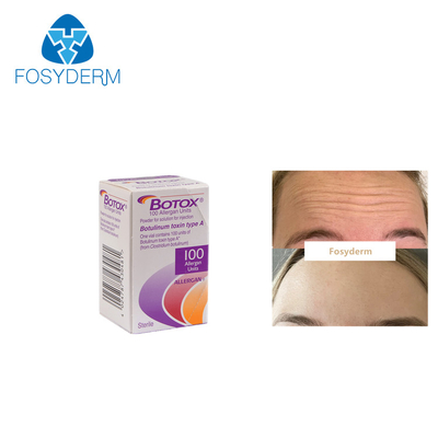 Το Allergan Botox 100 αντι ρυτίδες τοξινών μονάδων Botulinum δακτυλογραφεί μια έγχυση