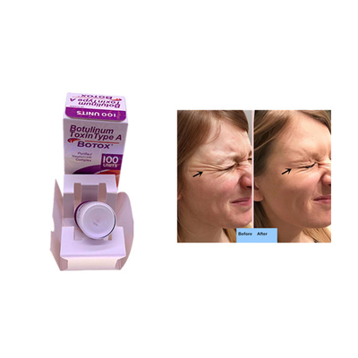 Allergan 100 μονάδες για τη δερμική έγχυση υλικών πληρώσεως αφαίρεσης ρυτίδων