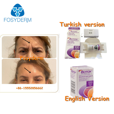 100Units Allergan Botulinum Toxion για αφαιρούν τον του προσώπου τύπο Α  ρυτίδων
