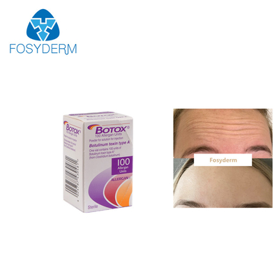 100Units Allergan Botulinum Toxion για αφαιρούν τον του προσώπου τύπο Α  ρυτίδων
