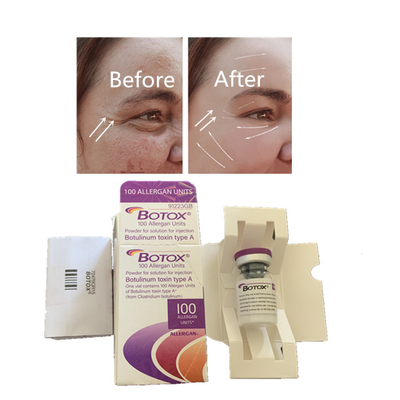 Botulinum έγχυση τοξινών  Allergan για την αντι γήρανση αντι ρυτίδων