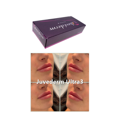 2 ml Υαλουρονικού οξέος δερματικό γέμισμα Juvederm Voluma For Anti Aging Ultra3 Ultra4