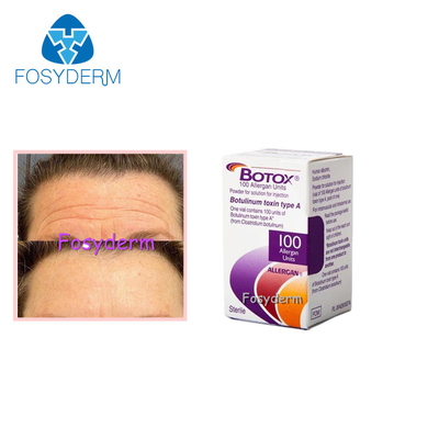 100 μονάδες Botulinum Toxin Allergan Απομάκρυνση ρυτίδων προσώπου Ένεση Μποτόξ τύπου Α