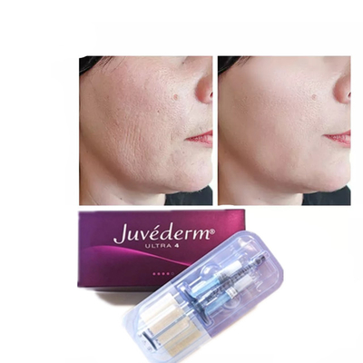 Το Juvederm Hyaluronic Acid Dermal Filler Anti Aging 2*1ml Φαγικό Φαγικό