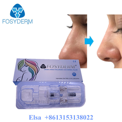 Fosyderm Deep 2 ml Dermal Filler για την αναζωογόνηση του προσώπου