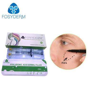 Fosyderm Deep 2 ml Dermal Filler για την αναζωογόνηση του προσώπου
