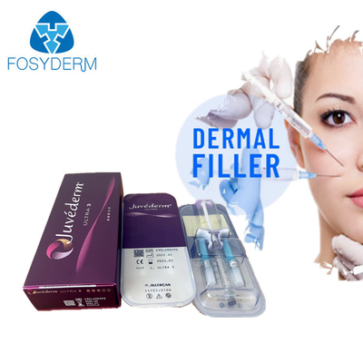 Juvederm Ultra3 Ενέσιμο Δερμικό Συμπλήρωμα Ενέσιμη Υαλουρονικό οξύ για το πρόσωπο