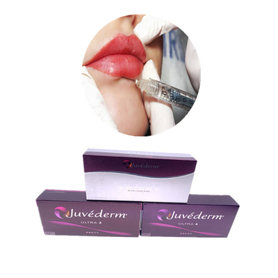 Απομάκρυνση ρυτίδων Juvederm Υαλουρονικό οξύ για χείλη Μάγουλο Πηγούνι