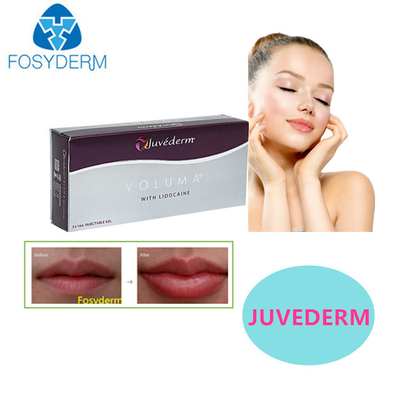 Juvederm Hyaluronic Acid Dermal Filler Σεξουαλικά χείλη 24mg Για το πρόσωπο
