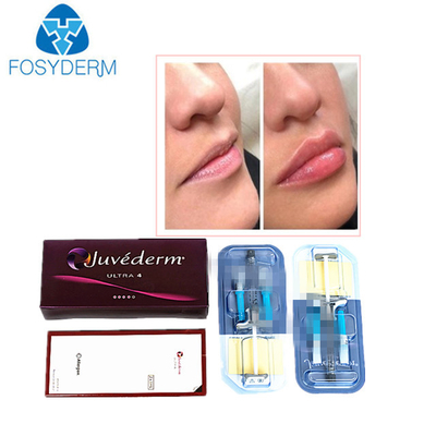 Juvederm Hyaluronic Acid Dermal Filler Anti Wrinkles Ένεση για το πρόσωπο