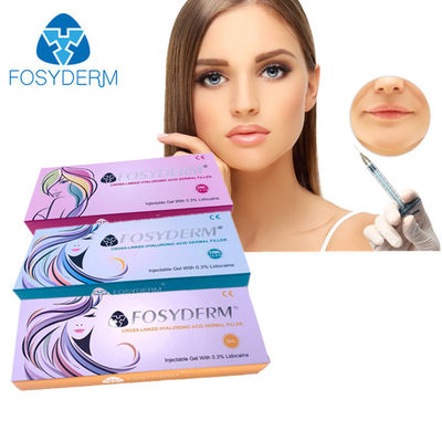 Fosyderm HA πλήρωσης έγχυσης για το πρόσωπο και το σώμα 1ml 2ml 5ml 10ml 20ml 50ml