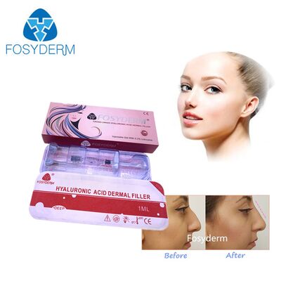 Hyaluronic Acid Dermal Filler for Facial Elegance and Lip Enhancement Injection