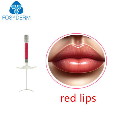 Lip Volume with Vitamin B12 1ml 24mg/Ml Δερματικό Filler Hyaluronic Acid Red Lip Filler