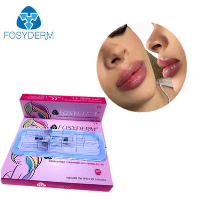 Fosyderm Filler Υαλουρονικό οξύ Δερματικό γεμιστήρα Ενέσιμα για χείλη 2 ml