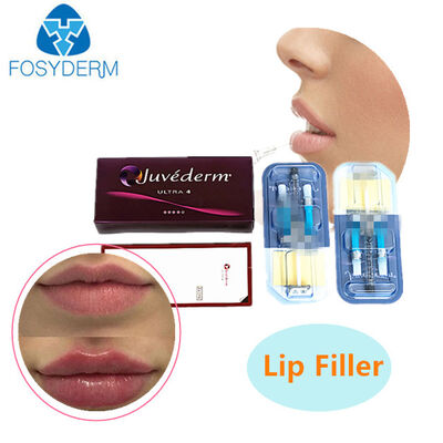 Juvederm Υαλουρονικό οξύ δερματικό γεμιστήρα για χειλιές και lifting προσώπου 24mg