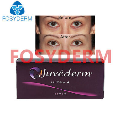 Juvederm Υαλουρονικό οξύ δερματικό γεμιστήρα για χειλιές και lifting προσώπου 24mg