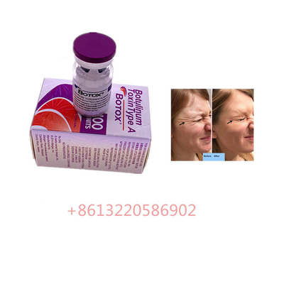 Η Botulinum τοξίνη Allergan δακτυλογραφεί ένα  100 αντι μονάδες γήρανσης αντι ρυτίδων