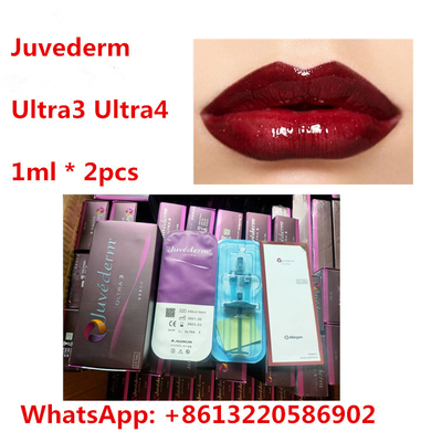 Δερμικό υλικό πληρώσεως χειλικού εκταρίου Juvederm με τη λιδοκαΐνη Ultra3 Ultra4