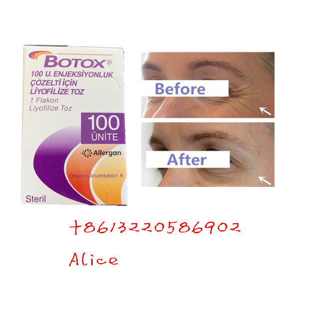 Η Botulinum τοξίνη Allergan αντι ρυτίδων γήρανσης αντι δακτυλογραφεί μια σκόνη