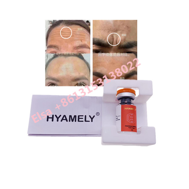 Η Botulinum τοξίνη  Hyamely δακτυλογραφεί ένα κορεατικό καλλυντικό  100u
