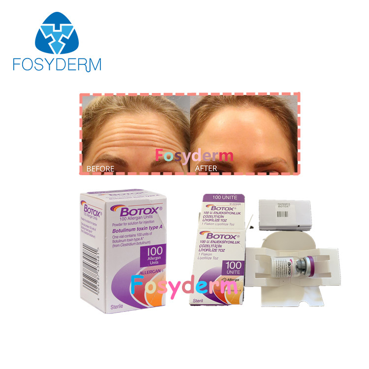 100Units Botulinum αντι έγχυση TypeA  Allergan τοξινών ρυτίδων