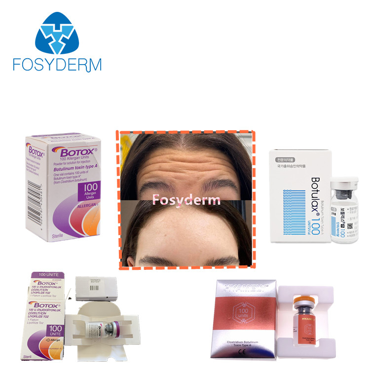 αντι ρυτίδες  Allergan εγχύσεων τοξινών 100units TypeA Botulinum