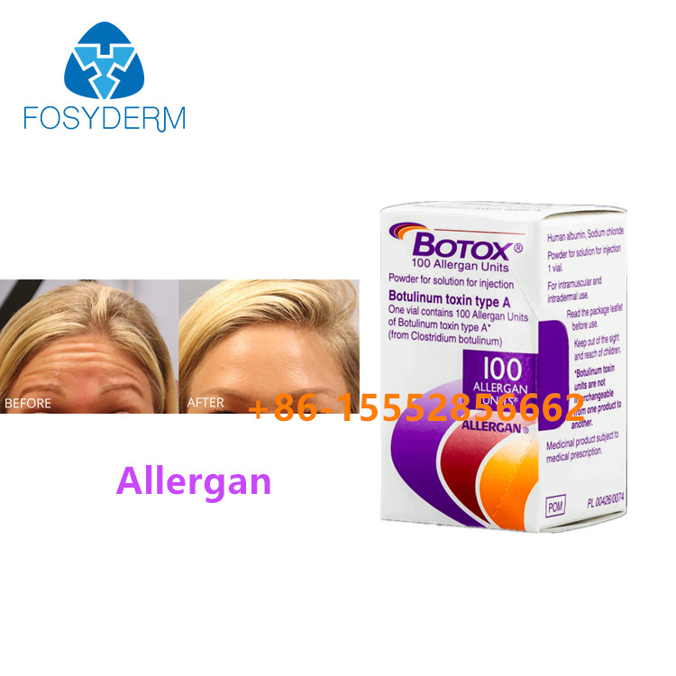 100 μονάδες Botulinum Toxin Allergan Απομάκρυνση ρυτίδων προσώπου Ένεση Μποτόξ τύπου Α