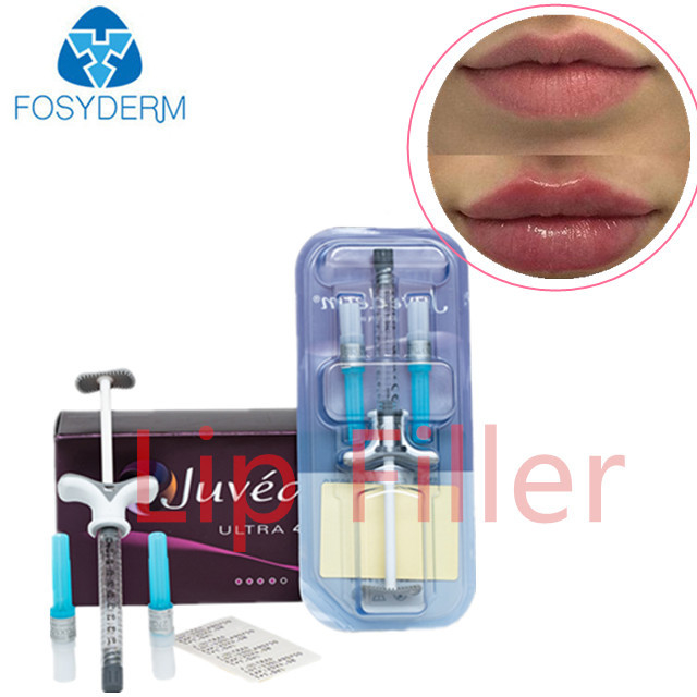 Διαφανές Juvederm Ultra 3 Lips Filler Υαλουρονικό οξύ Δερματικό Filler για πρόσωπο και σώμα