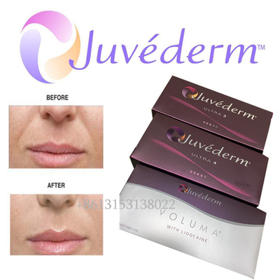 Μακράς διαρκείας Ultra3 Ultra4 Voluma Juvederm Hyaluronic όξινη του προσώπου έγχυση υλικών πληρώσεως