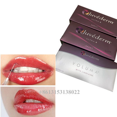 Juvederm Voluma Υαλουρονικό οξύ δερματικό γέμισμα Gel 24mg/ ml δερματικά γέμισμα