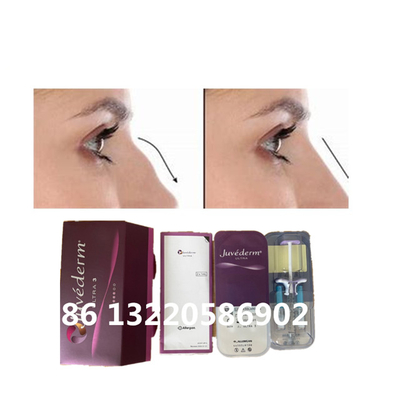 Hyaluronic όξινος δερμικός υλικών πληρώσεως μύτης Juvederm Ultra3 Ultra4 Voluma