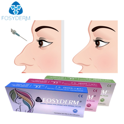 Hyaluronic όξινη δερμική έγχυση 1ml 2ml υλικών πληρώσεως μύτης για τη θηλυκή χρησιμοποίηση