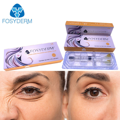 5ml Hyaluronic όξινη έγχυση υλικών πληρώσεως Fosyderm δερμική για τη χειλική μύτη