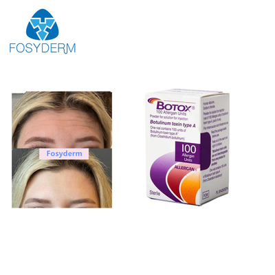 Οι Botulinum εγχύσεις τοξινών Allergan αφαιρούν τις ρυτίδες 100 μονάδες