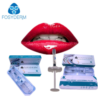 Έγχυση Fosyderm 1ml Derm υλικών πληρώσεως χειλικού πιό παχουλή εκταρίου