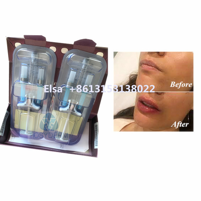 Προϊόν ομορφιάς Juvederm Voluma Υαλουρονικό οξύ
