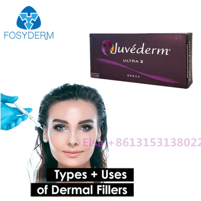 Δερμική σύριγγα Juvederm υλικών πληρώσεως Voluma/εξαιρετικά Juvederm με Lido