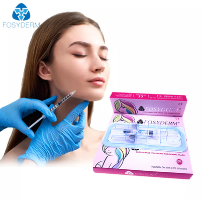 Hyaluronic όξινα δερμικά χείλια υλικών πληρώσεως Fosyderm εκχύσιμα