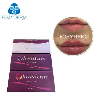 Juvederm Dermal Filler Injection Cross Linked Hyaluronic Acid HA Gel Face Filler Προγεμισμένη σύριγγα