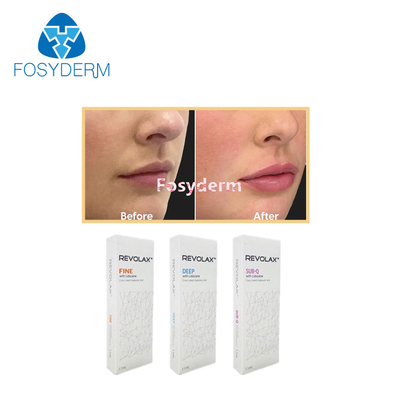 1.1 ml Dermal Lip Fillers Revolax Fine Deep Sub- Q για την Ενέσιμη Υαλουρονικό οξύ κατά των ρυτίδων